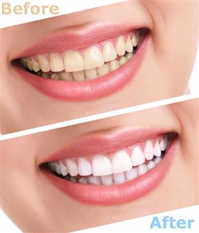 سفید کردن باورنکردنی دندان با روش طبیعی و خوشمزه