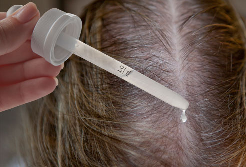 کشف جدید روش درمان ریزش مو