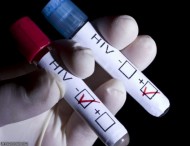 جدیدترین آمار مبتلایان به ایدز در ایران