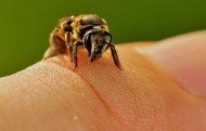 درمان نیش زنبور و گزیدگی با روشهای خانگی