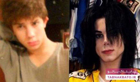 قبل و بعد از جراحی زیبایی برای شبیه شدن به مایکل جکسون
