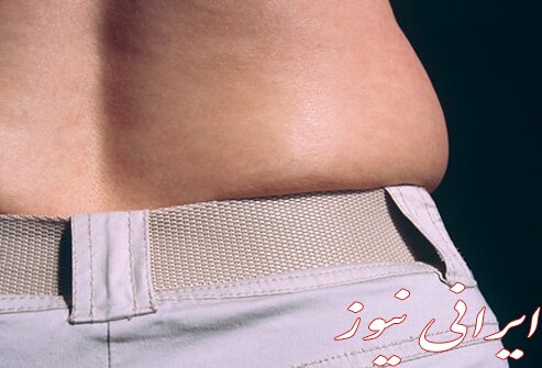 چاقی چیست و چگونه چاق میشویم؟