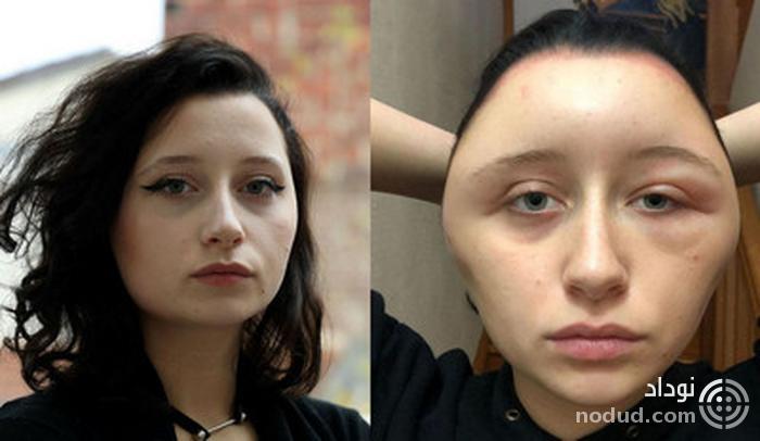 تغییر قیافه وحشتناک دختر زیبا پس از مصرف رنگ موی تقلبی ! + عکس 16+