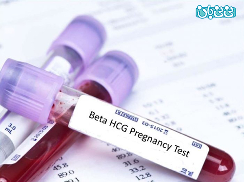 بهترین زمان آزمایش خون بارداری!