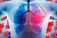 درمان آمبولی ریه با چه روش هایی امکان پذیر است؟