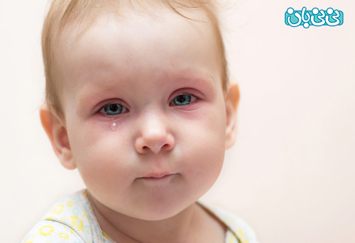 قرمزی چشم کودک نشانه چیست؟