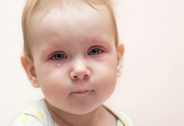 عفونت چشم در کودکان