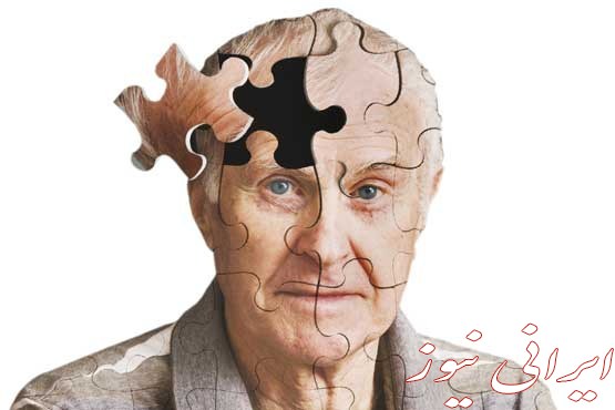 کشف جدید دانشمندان برای درمان آلزایمر