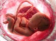 سقط خود به خودی جنین و انواع آن