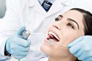 انواع سیستم های سفید کننده دندان که باید در نظر بگیرید