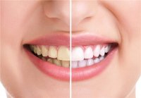 راه حل های ساده برای کاهش دندان درد