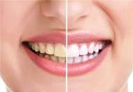 روش های ساده برای کاهش دندان درد