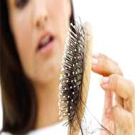 4 عامل مهم برای ریزش مو در مردان قبل از 30 سالگی