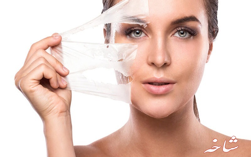 چپند روش ساده برای درمان جوش و آکنه های صورت